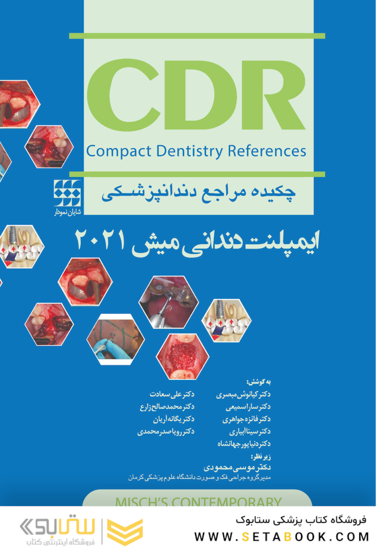 CDR چکیده مراجع دندانپزشکی ایمپلنت دندانی میش 2021