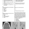 Neurosurgery Primary Examination Review: High Yield Questions, Answers, Diagrams, and Tables 1st Edicion 2019