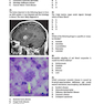 Neurosurgery Primary Examination Review: High Yield Questions, Answers, Diagrams, and Tables 1st Edicion 2019