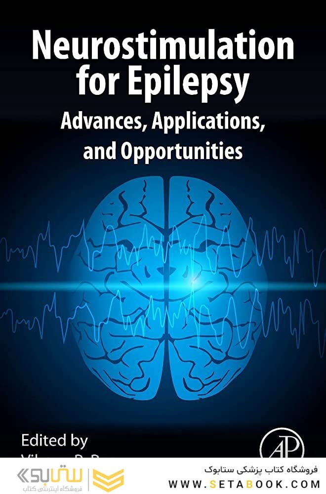 Neurostimulation for Epilepsy: Advances, Applications and Opportunities 2023