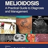 Clinical Melioidosis: A Practical Guide to Diagnosis and Management 1st Edition