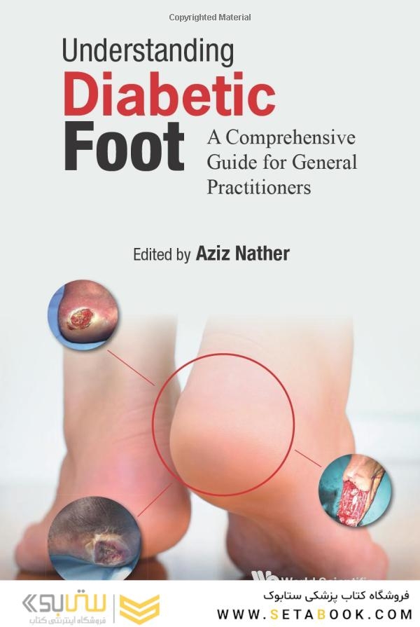 Understanding Diabetic Foot: A Comprehensive Guide For General Practitioners