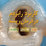 کاربرد رابردم در درمان ریشه چرا چه زمان چگونه