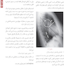 Book Brief خلاصه کتاب آموزش رادیولوژی شناخت اصول پایه ای (هرینگ 2022)