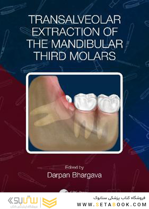 Transalveolar Extraction of the Mandibular Third Molars