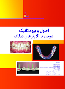 عکس اصول و بیومکانیک درمان با الاینرهای شفاف