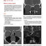 Cranial Nerves: Anatomy, Pathology, Imaging