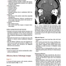 Cranial Nerves: Anatomy, Pathology, Imaging