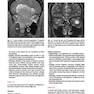 Cranial Nerves: Anatomy, Pathology, Imaging