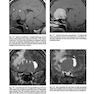 Cranial Nerves: Anatomy, Pathology, Imaging