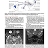 Cranial Nerves: Anatomy, Pathology, Imaging