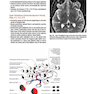 Cranial Nerves: Anatomy, Pathology, Imaging