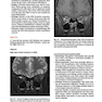 Cranial Nerves: Anatomy, Pathology, Imaging