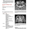 Cranial Nerves: Anatomy, Pathology, Imaging