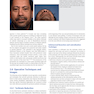 Global Rhinoplasty: A Multicultural Approach 1st Edicion 2023