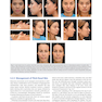 Global Rhinoplasty: A Multicultural Approach 1st Edicion 2023