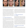 Global Rhinoplasty: A Multicultural Approach 1st Edicion 2023