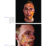 Non-Surgical Rhinoplasty (The PRIME Series) Kindle Edition
