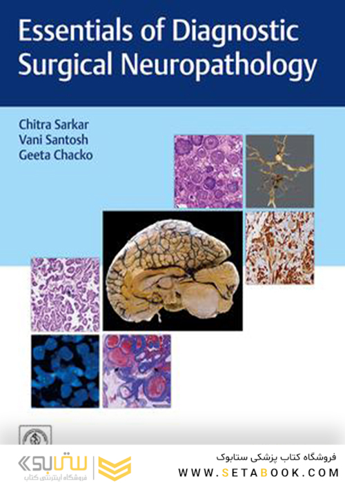Essentials of Diagnostic Surgical Neuropathology