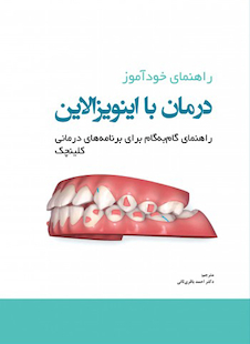 عکس راهنمای خودآموز درمان با اینویزالاین راهنمای گام به گام برای برنامه های درمانی کلینچک