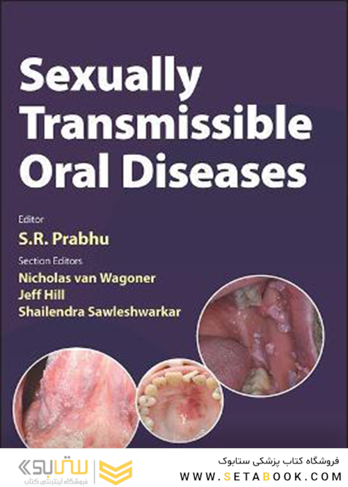 Sexually Transmissible Oral Diseases 1st Edition, Kindle Edition