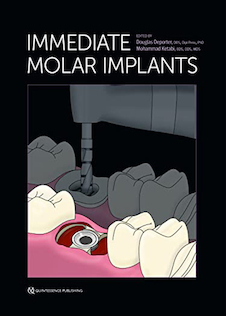 عکس Immediate Molar Implants Kindle Edition