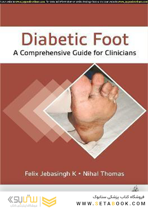 Diabetic Foot : A Comprehensive Guide for Clinicians 1st Edition, Kindle Edition
