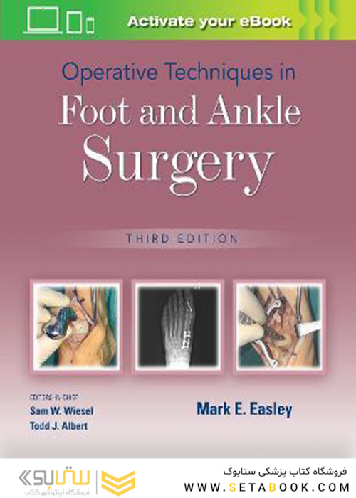 Operative Techniques in Foot and Ankle Surgery Third Edition