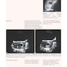 Examination Review for Ultrasound: Abdomen and Obstetrics & Gynecology Third Edition