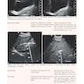 Examination Review for Ultrasound: Abdomen and Obstetrics & Gynecology Third Edition