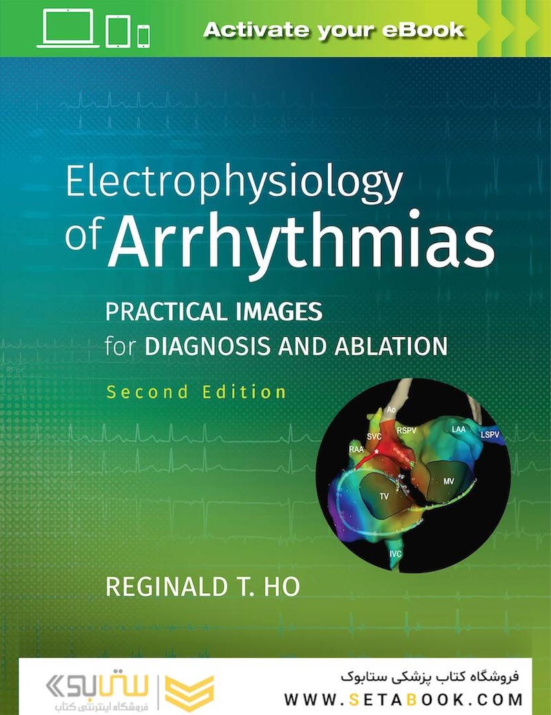 Electrophysiology of Arrhythmias: Practical Images for Diagnosis and Ablation 2nd Edicion 2020