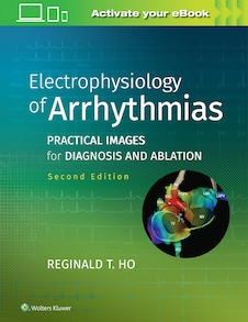 عکس Electrophysiology of Arrhythmias: Practical Images for Diagnosis and Ablation 2nd Edicion 2020