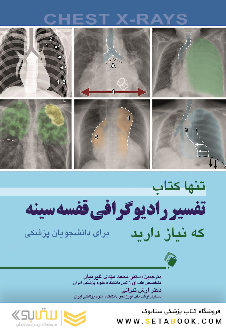 تنها کتاب تفسیر رادیوگرافی قفسه سینه که نیاز دارید