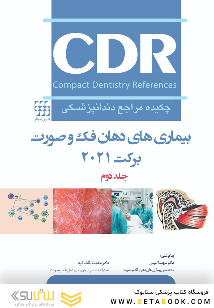 CDR چکیده مراجع دندانپزشکی بیماری های دهان، فک و صورت برکت 2021  جلد دوم