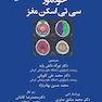 خودآموز سی  تی اسکن مغز