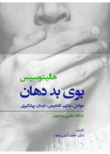 عکس هالیتوسیس بوی بد دهان