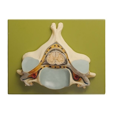 عکس پنجمین مهره گردن