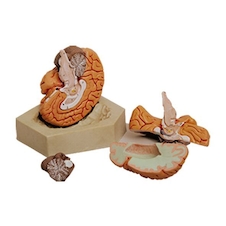 عکس مغز 4 قسمتی