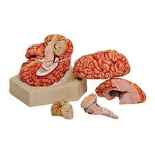 عکس مغز 8 قسمتی