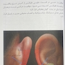 اولین مرجع طب سوزنی گوش 2022