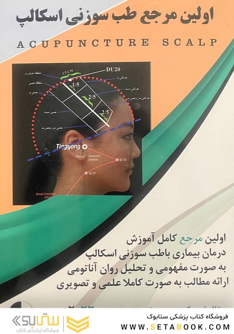 اولین مرجع طب سوزنی اسکالپ 2022