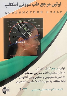 عکس اولین مرجع طب سوزنی اسکالپ 2022