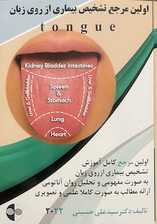 عکس اولین مرجع تشخیص بیماری از روی زبان 2022
