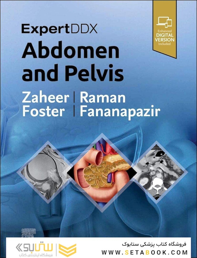 ExpertDDx: Abdomen and Pelvis, 3rd Edition 2023