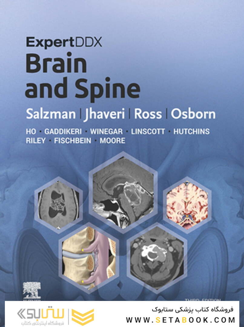 ExpertDDx: Brain and Spine 3rd Edicion 2024