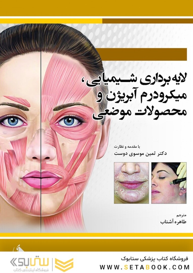 لایه برداری شیمیایی،میکرودرم آبریژن و محصولات موضعی
