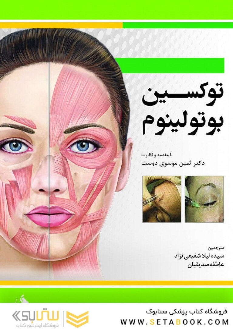 توکسین بوتولینیوم