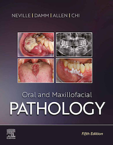 عکس Oral and Maxillofacial Pathology 5th Edicion 2024