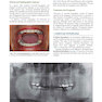 Oral and Maxillofacial Pathology 5th Edicion 2024