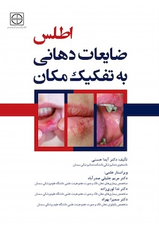 عکس اطلس ضایعات دهانی به تفکیک مکان